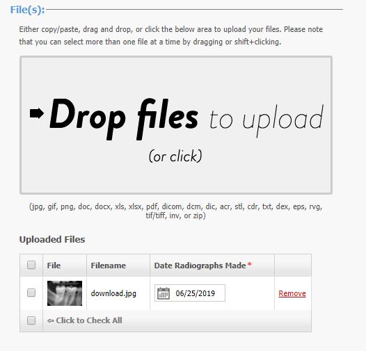 Radiographs from your computer are uploaded