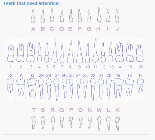 Select the tooth/teeth that need attention